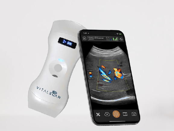 VitalScan_Dual_Head_X5_-_4-removebg-preview